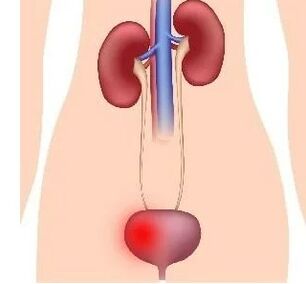 Causes of Cystitis developing women