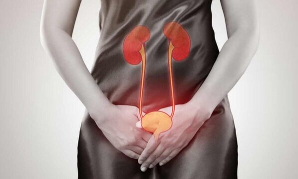 Cause and treatment of cystitis in women