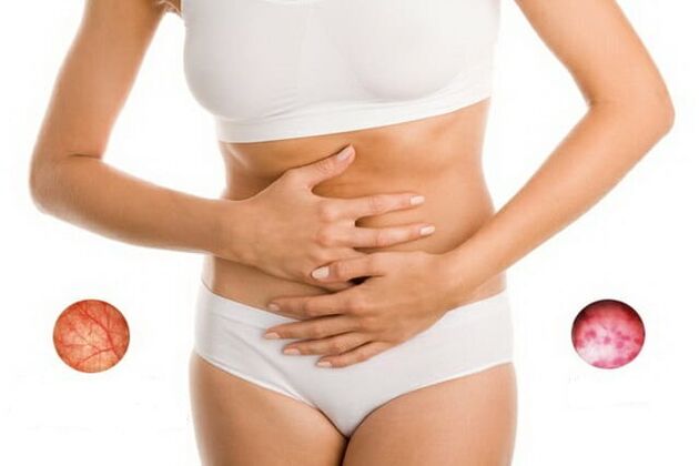 abdominal pain caused by cystitis